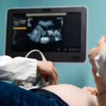 4D Ultrasound Cost